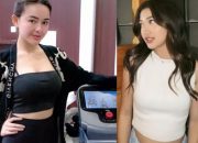 Inovasi Kecantikan Terbaru, Amanda Manopo Ungkap Rahasianya